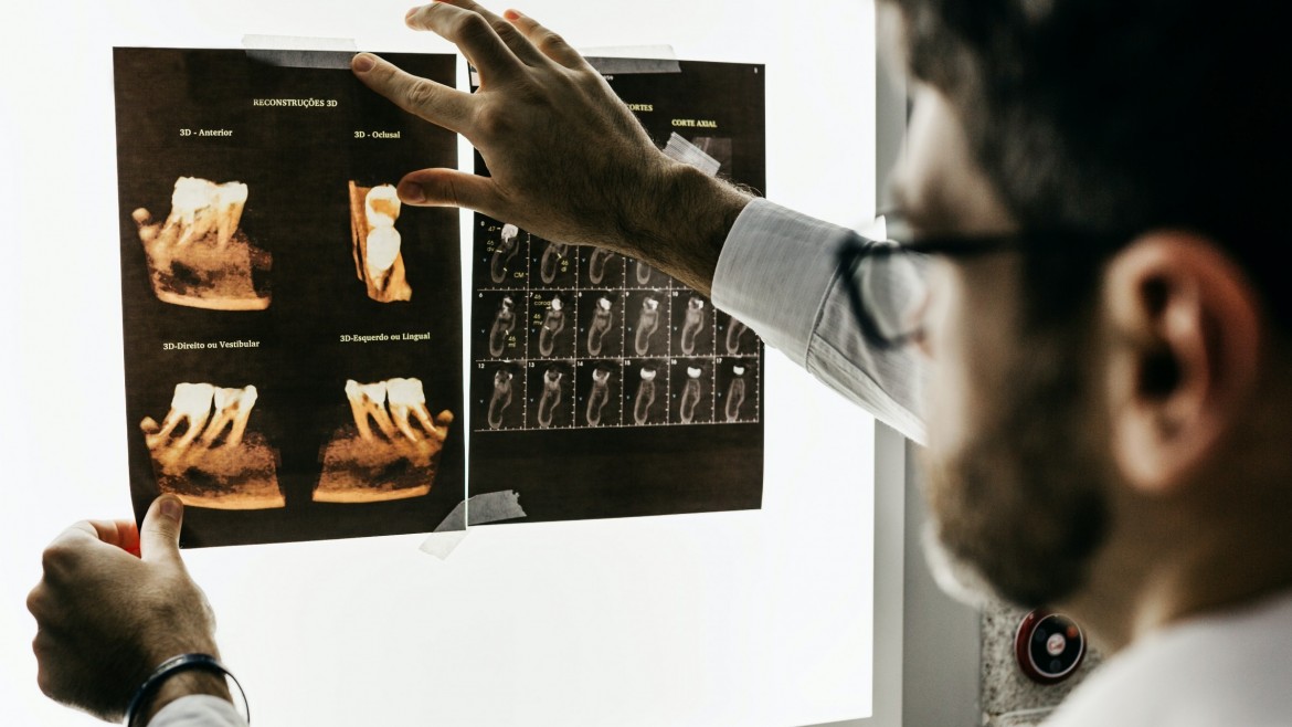 Dlaczego sztuczna inteligencja nie zastąpi radiologów?