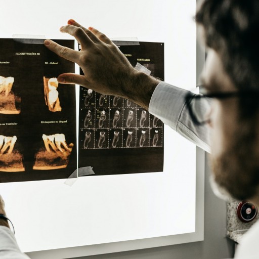 Dlaczego sztuczna inteligencja nie zastąpi radiologów?